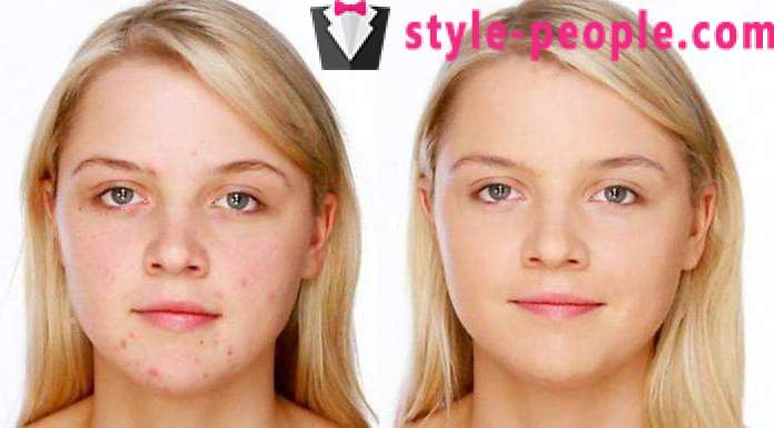 Gesichtsmaske „Polisorb“: die Wirksamkeit Bewertungen