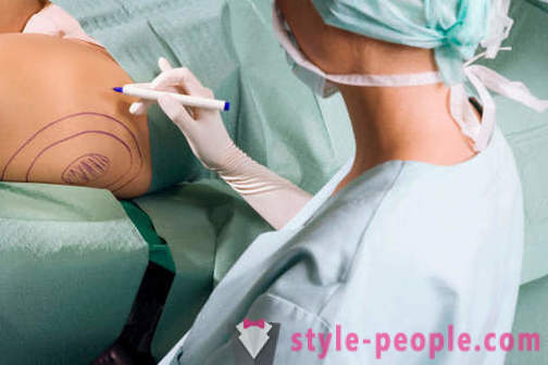 Plastische Chirurgen zerstören Klischees über ihre Arbeit