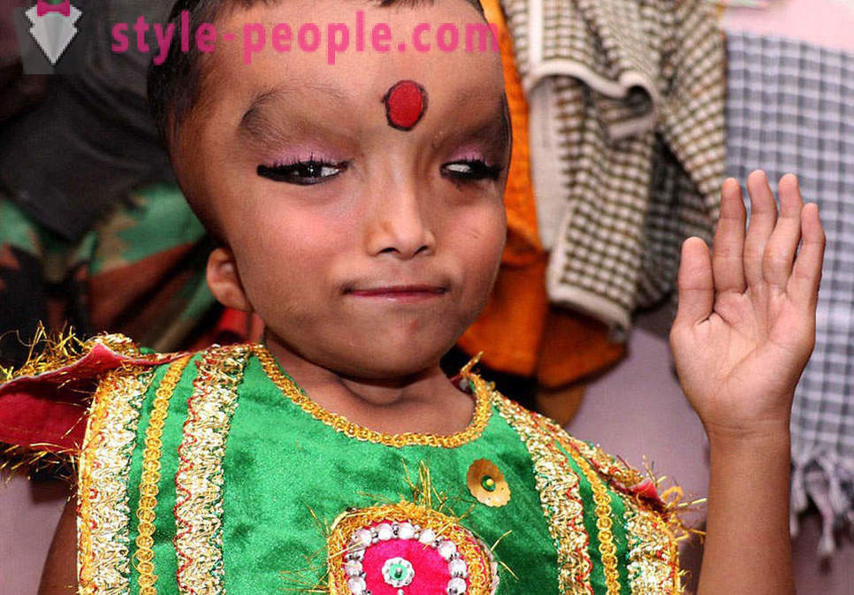 Das indische Dorf verehrte Jungen mit einem deformierten Kopf als Gott Ganesha