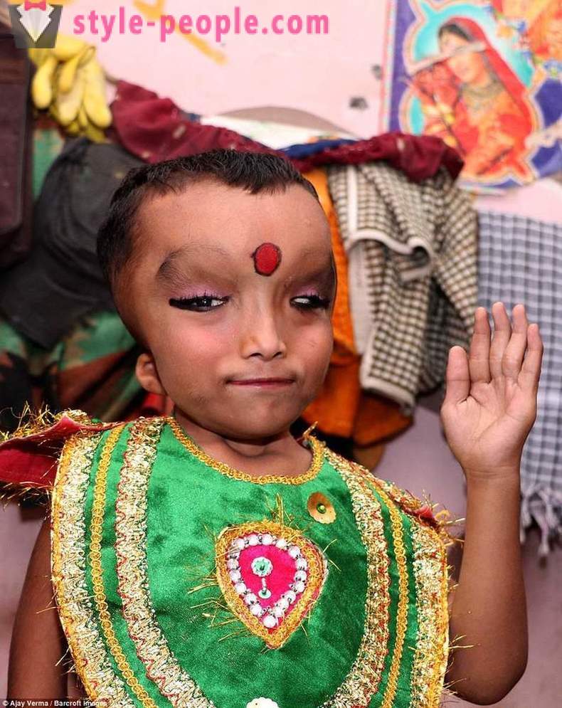 Das indische Dorf verehrte Jungen mit einem deformierten Kopf als Gott Ganesha