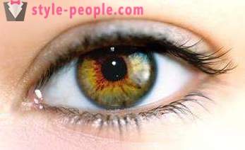 Selten welche augenfarbe ist Augenfarben