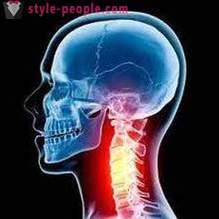 Übungen in Osteochondrose der Hals-, Brust-, Lenden- und Becken